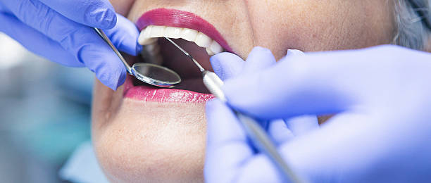 Best Emergency Wisdom Tooth Extraction in Montrose, MI
